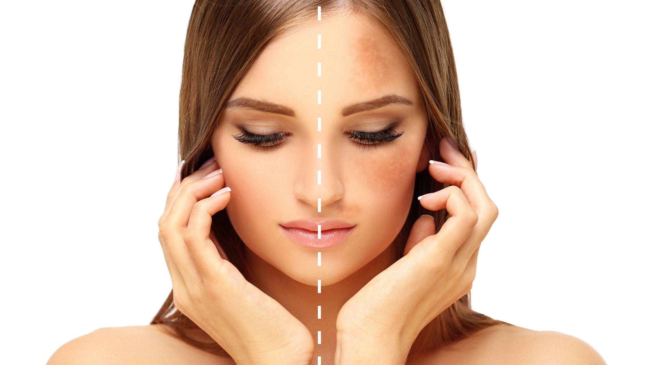 Treatments for Pigmentation