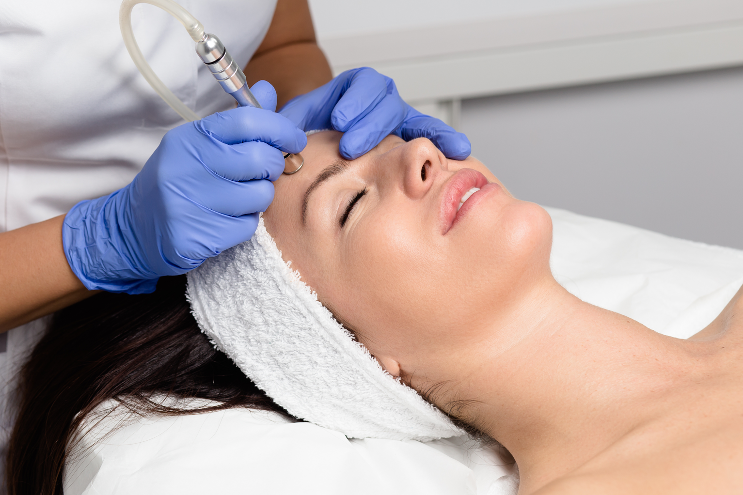 microdermabrasion treatment​